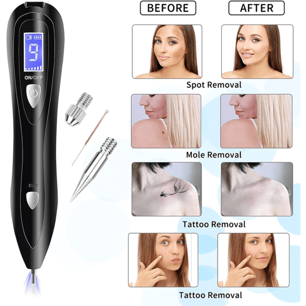 Mole Removal Pen (9 Level)